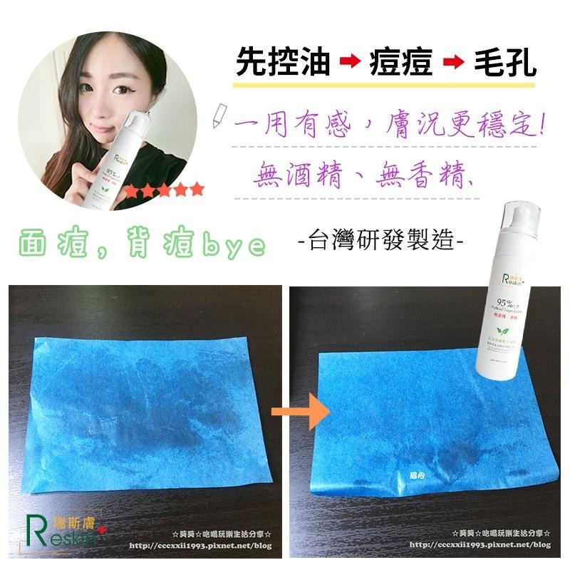 現貨！瑞斯膚Reskin! 痘痘控油一瓶搞定 台灣製 真的有感 賦活煥膚植萃精露 天然植萃化妝水抗痘背痘水楊酸杏仁酸-細節圖4