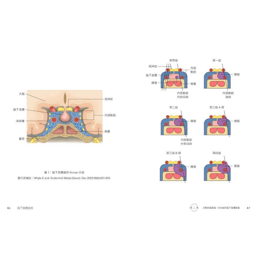 書適》腦下垂體真相：你不知道的內分泌健康問題 /天下生活-細節圖6