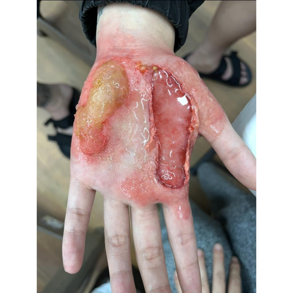 燒燙傷凝膠 明膠 Effects Gel 美國原裝BenNye 透明水泡 血塊 腫脹 疤痕 血跡 割傷 撕裂傷-細節圖3