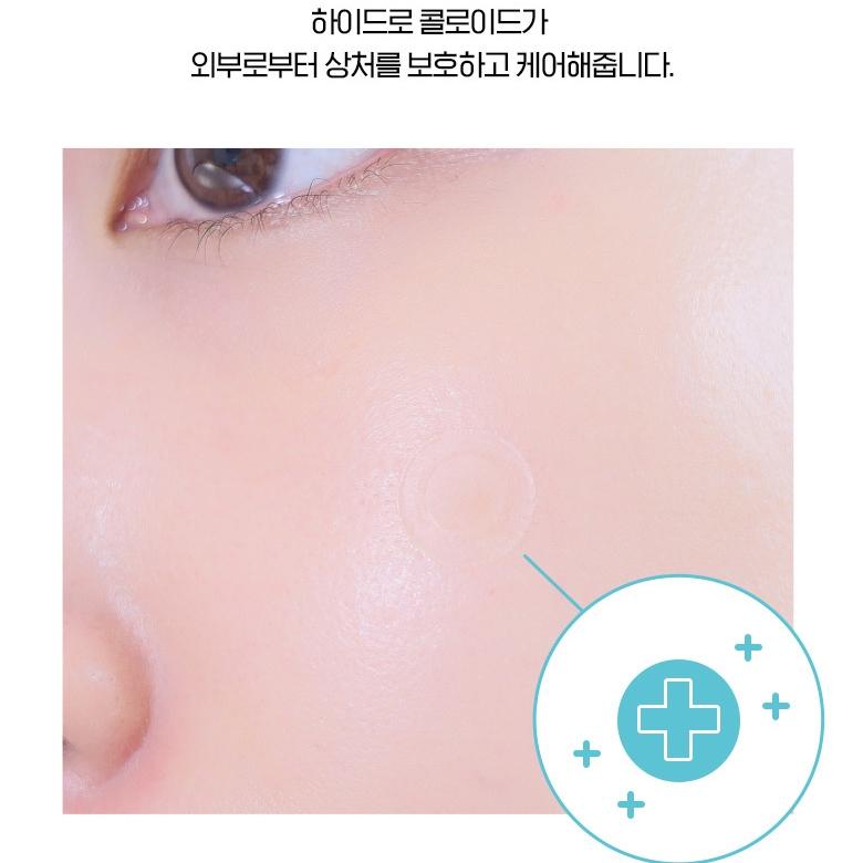 【韓氏愛美】CAREPLUS 超薄隱形痘痘貼 102枚入 韓國 Olive Young 范冰冰痘痘貼-細節圖3