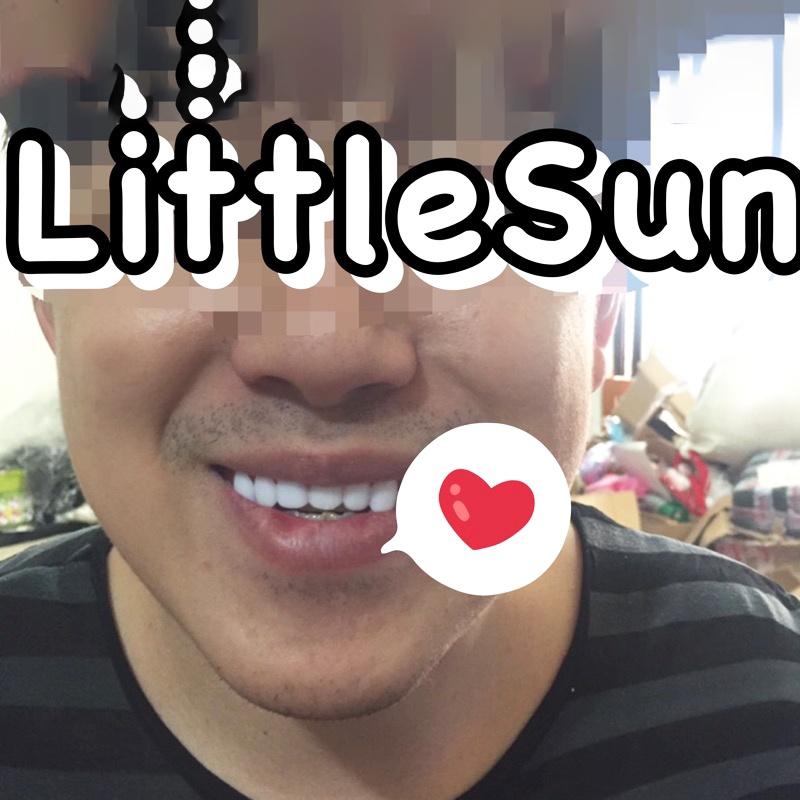 現貨 上排假牙 美白假牙貼片 美白貼片 假牙 美白 拍照神器 拍照道具 美齒-細節圖4