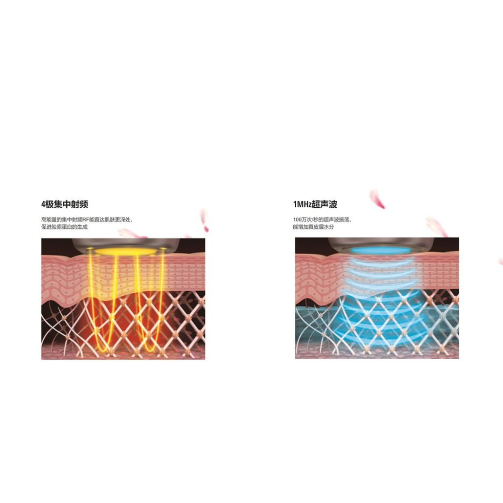 PANASONIC 頂級超聲波射頻美容儀EH-XRF1-細節圖4