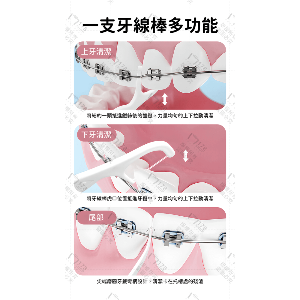 矯正牙線棒 100入 矯正專用【178小舖】雙線牙線棒 矯正牙線 牙籤 牙線棒 牙線 雙線牙線 牙間刷 牙套清潔-細節圖8