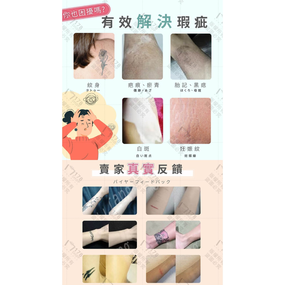 遮瑕貼 自然膚色 防水防汗不脫落【178小舖】超隱形遮瑕貼 遮刺青貼 刺青貼 遮疤痕 遮暇貼布 遮蓋刺青 遮曬痕貼-細節圖3