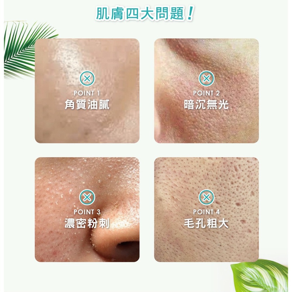 日本純穗 天然有機淨白淡斑霜EX30ml*1【贈】舒妃 玻尿酸清爽涼感洗面乳100ml*1 效期2026.03.29-細節圖5