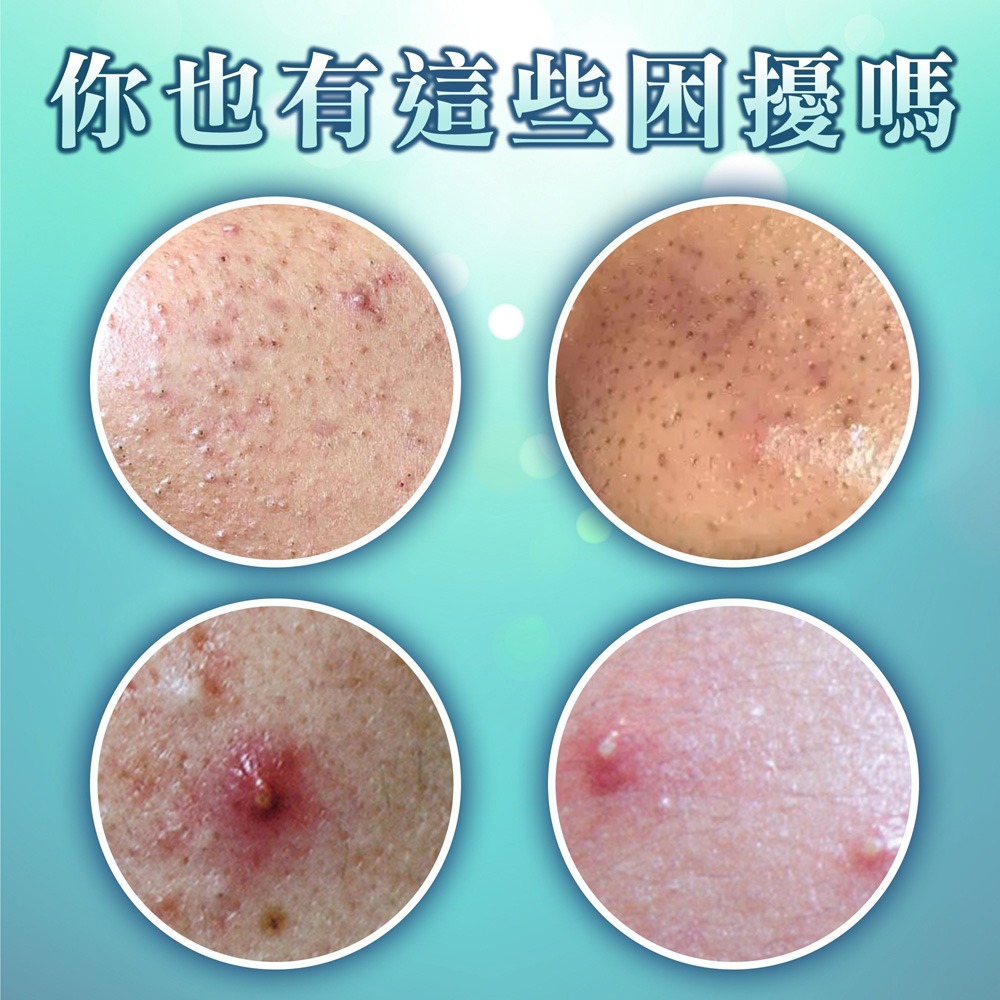 sunVenus面部淨化精華5ml*1【贈】我的心機 NEO CLEAR法國綠礦泥毛孔速淨泥膜棒45g*1-細節圖3