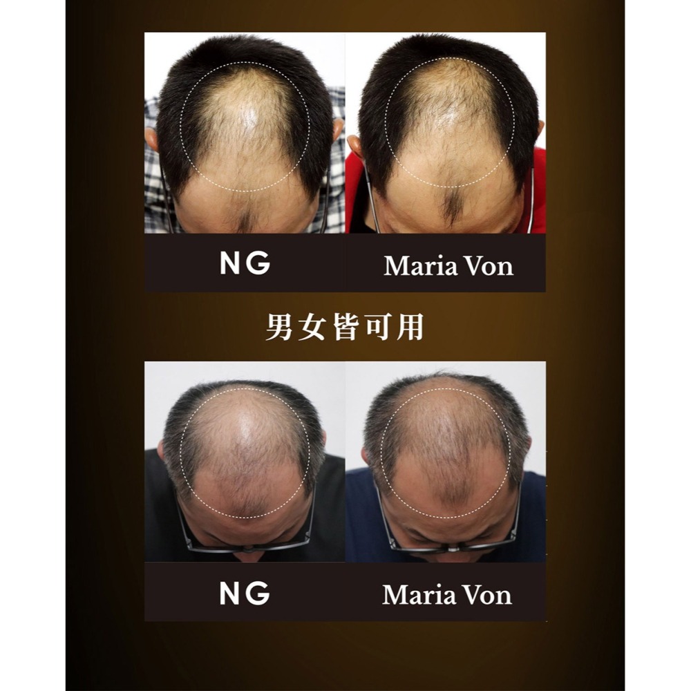 Maria Von 泌．人蔘菁泌養髮賦活噴霧 8ml*1【贈】德國草本耀典 摩洛哥堅果護髮油 100ml*1-細節圖5