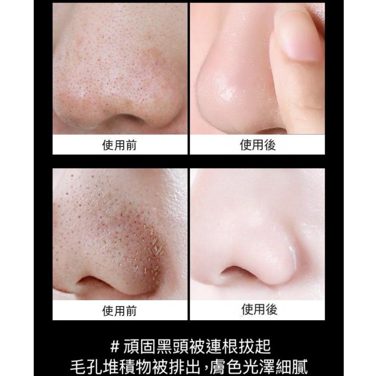 【台灣現貨火速寄出】備長炭去黑頭鼻膜膏 20g 柔亮細膚 吸黑頭 浮離 黑頭粉刺 保濕滋潤-細節圖6