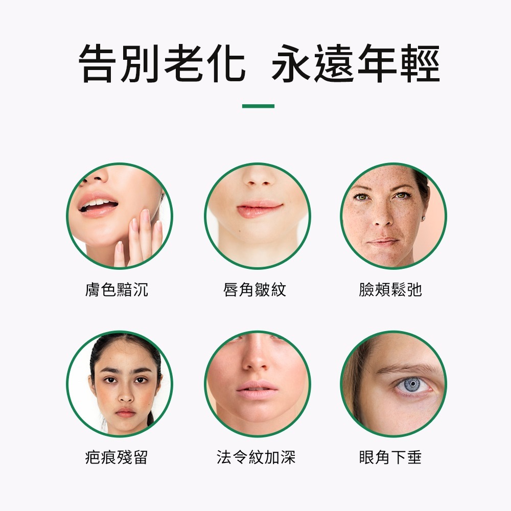 【NORDITION】提拉棒 ◆ 美顏器 3D滾珠-細節圖6