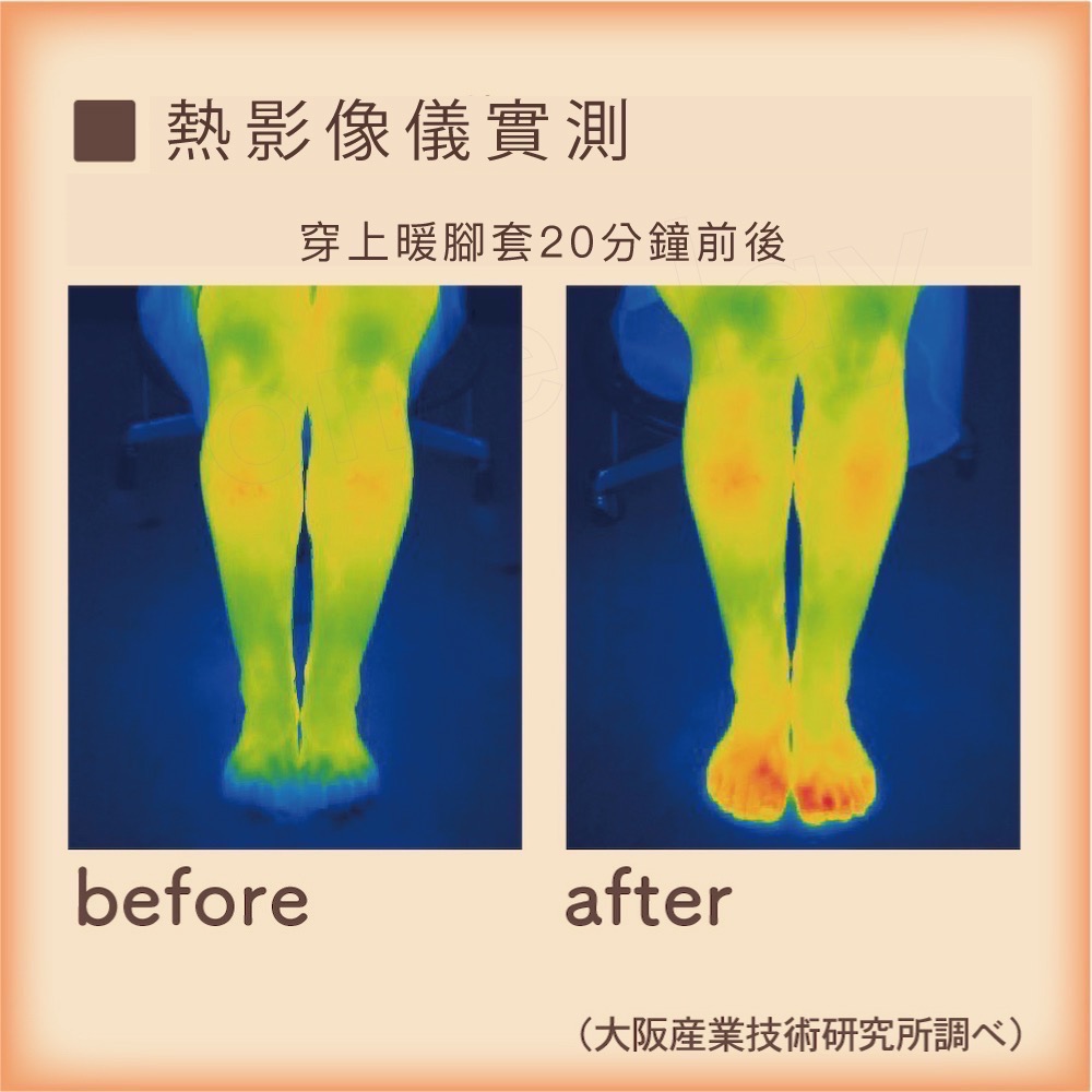 Alphax 極暖暖腳套-細節圖4