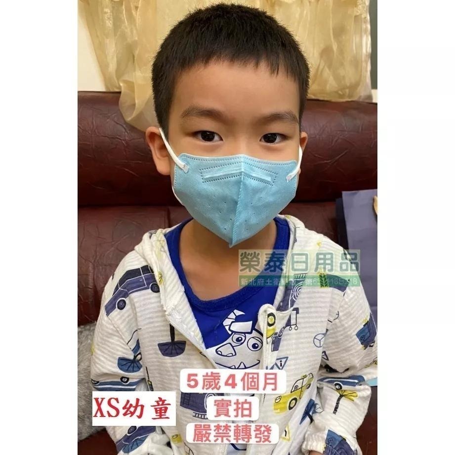 【榮泰日用品】順易利幼童立體醫用口罩 順易利兒童立體醫療口罩/鬆緊帶扁繩4層口罩/有壓條/30片裝 3D兒童口罩-細節圖3
