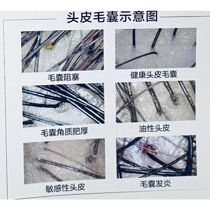 ✝️辰晞髮品✝️ 頭皮檢測儀 毛髮檢測儀 800倍數-細節圖4